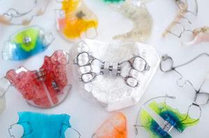 Orthodontie interception jeune enfant